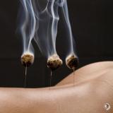 Moxibustion